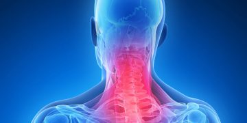 Unleash the Chains of Neck Pain: A Comprehensive Guide to Lasting Relief