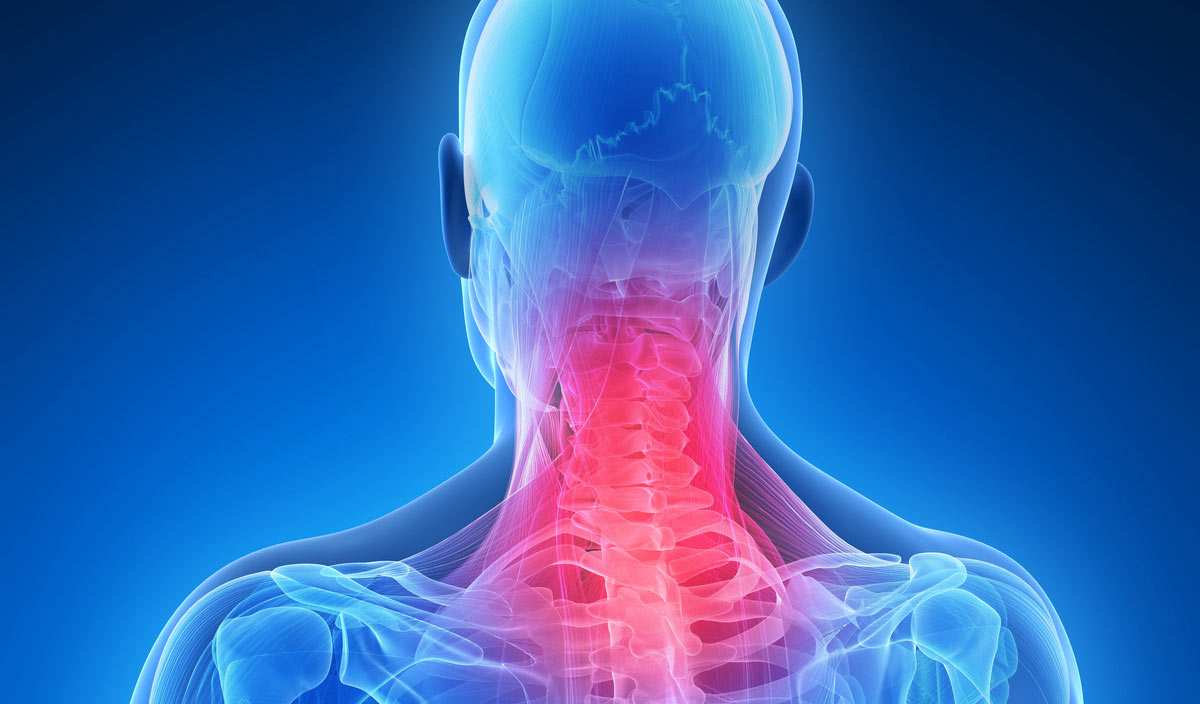neck pain treatment ross physio clinic
